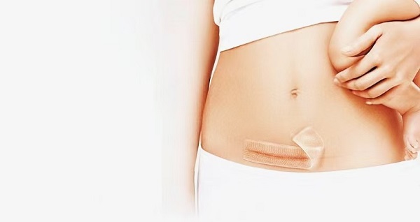 Tại sao miếng dán trị sẹo bằng gel silicon dày lại được ưa chuộng đến vậy?