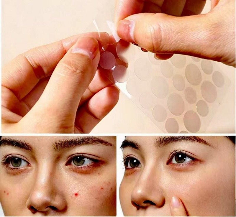 Cách sử dụng miếng dán mụn CmallBio qua đêm để có kết quả tối đa？