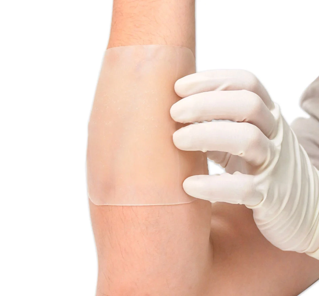 Bordered Hydrocolloid Dressing Roll With Pull Tab For Catheter Securement